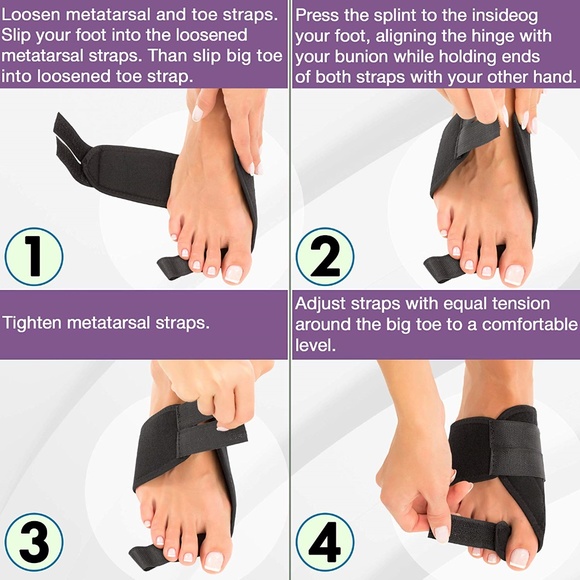 Bunion Splints Bunion Corrector - Picture 6 of 7